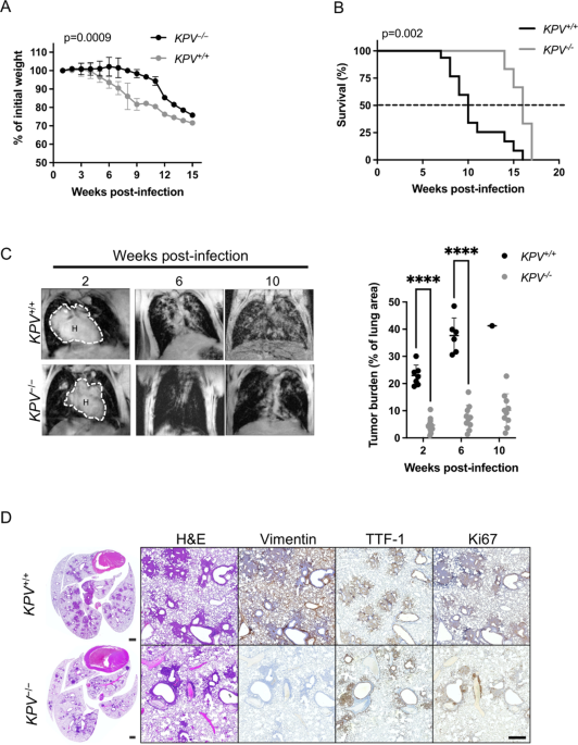 Vimentin is required for tumor progression and metastasis in a mouse model of non–small cell lung cancer