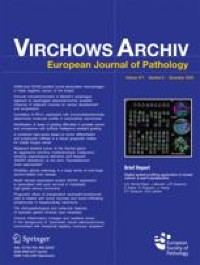 Round-Robin test for the histological diagnosis of acute colonic Graft-versus-Host disease validating established histological criteria and grading systems
