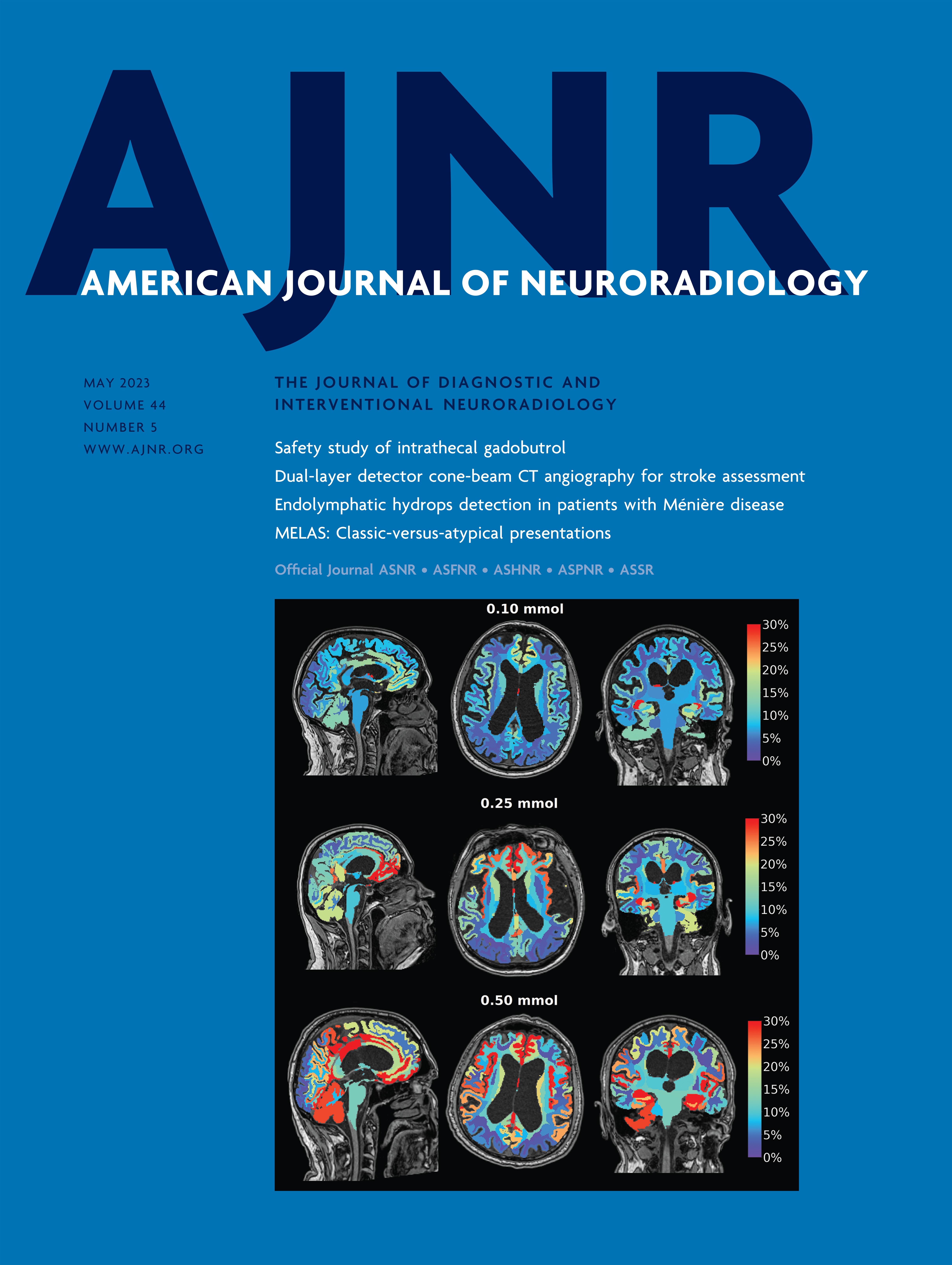 MELAS: Phenotype Classification into Classic-versus-Atypical Presentations [PEDIATRICS]