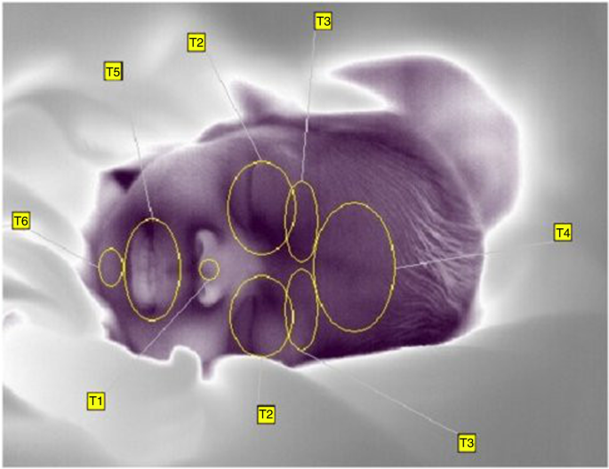 Facial thermal response to non-painful stressor in premature and term neonates