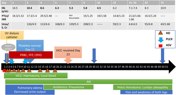 Delayed Compression Paralysis Following an Iliopsoas Hematoma 30 Days After Saw-Scaled Viper (Echis carinatus sochureki) Envenoming: A Case Report