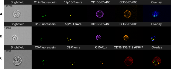Enhanced multi-FISH analysis of immunophenotyped plasma cells by imaging flow cytometry