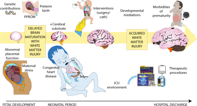 Preterm congenital heart disease and neurodevelopment: the importance of looking beyond the initial hospitalization
