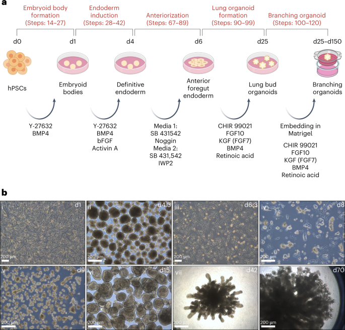 A distal lung organoid model to study interstitial lung disease, viral infection and human lung development