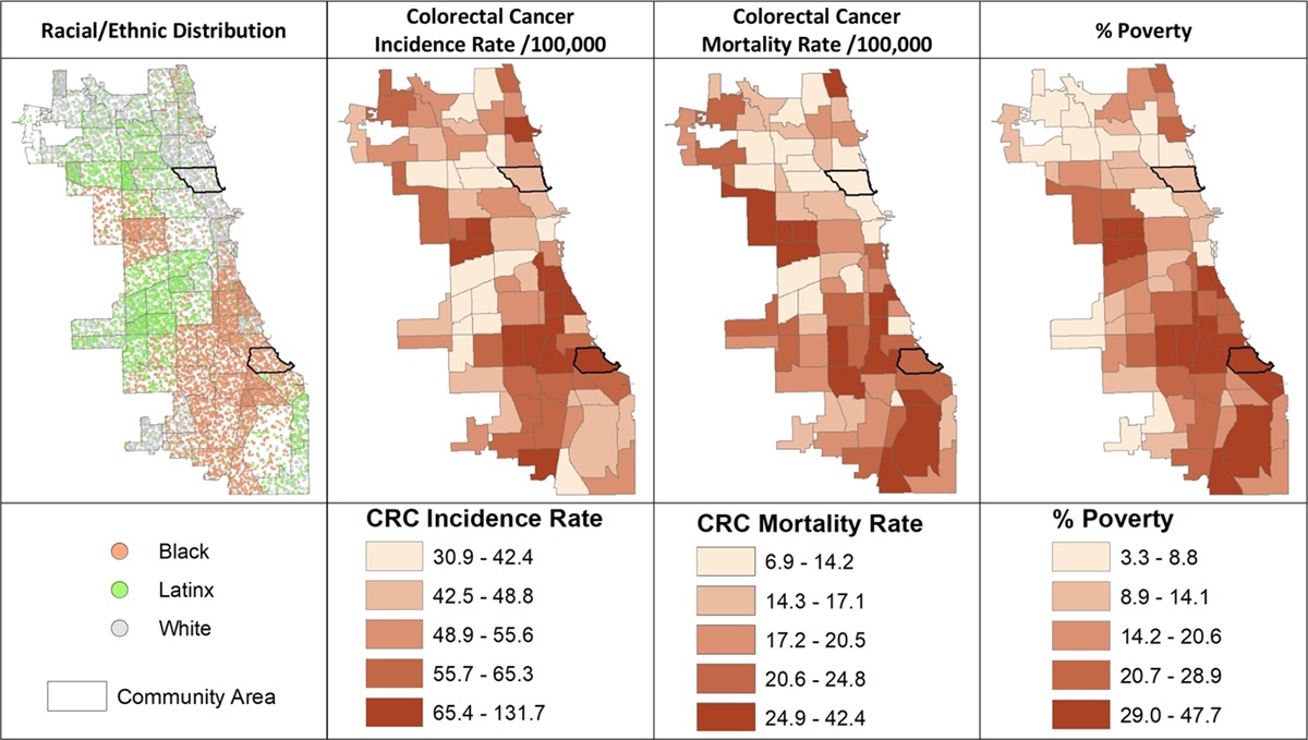 Socioenvironmental Stressors, Gut Microbes, and Colorectal Cancer Inequities: A Chicago Perspective