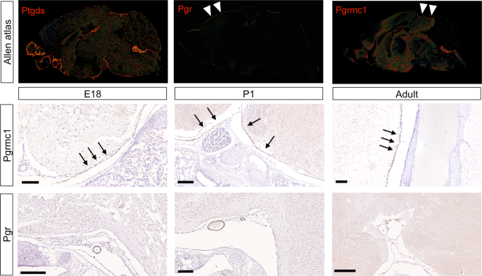 Respective roles of Pik3ca mutations and cyproterone acetate impregnation in mouse meningioma tumorigenesis