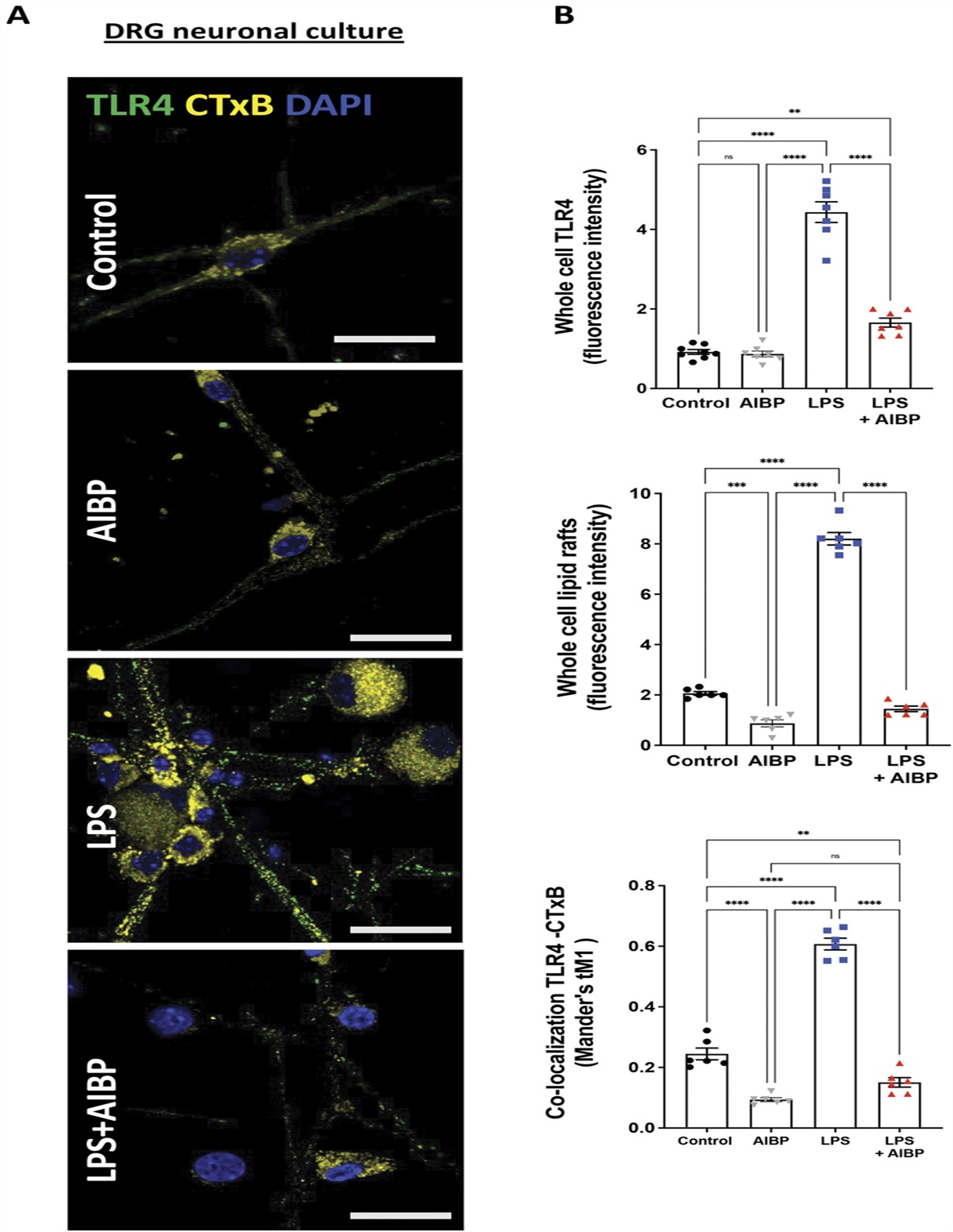 AIBP regulates TRPV1 activation in chemotherapy-induced peripheral neuropathy by controlling lipid raft dynamics and proximity to TLR4 in dorsal root ganglion neurons