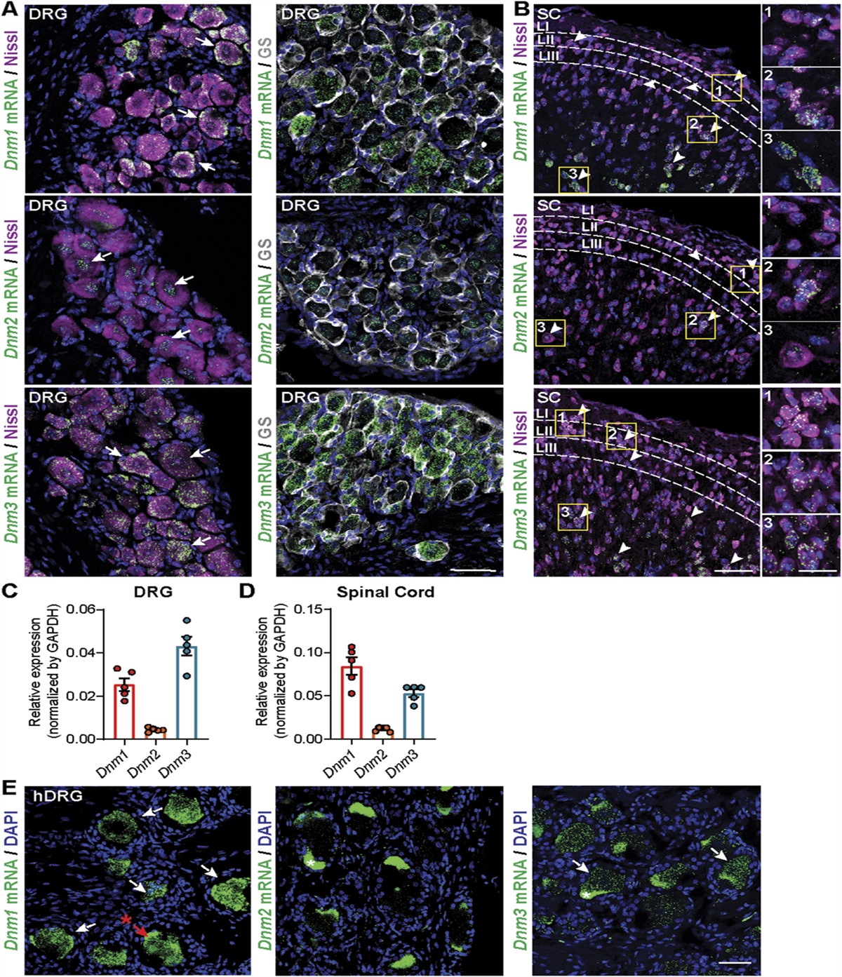 The contribution of endocytosis to sensitization of nociceptors and synaptic transmission in nociceptive circuits
