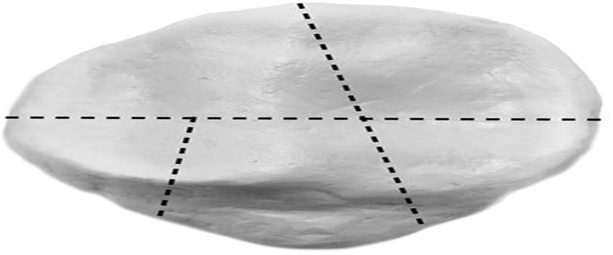 Anterior Hook Plating of Patella Fractures: A Biomechanical Analysis and Clinical Series
