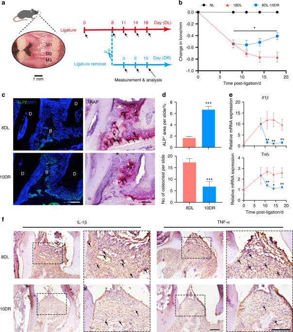CD301b+ macrophage: the new booster for activating bone regeneration in periodontitis treatment