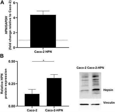 Venetoclax is a potent hepsin inhibitor that reduces the metastatic and prothrombotic phenotypes of hepsin-expressing colorectal cancer cells