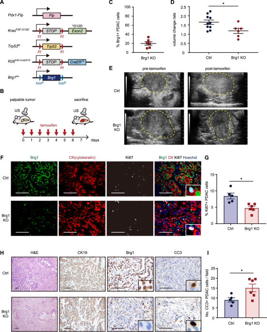 Brg1 controls stemness and metastasis of pancreatic cancer through regulating hypoxia pathway