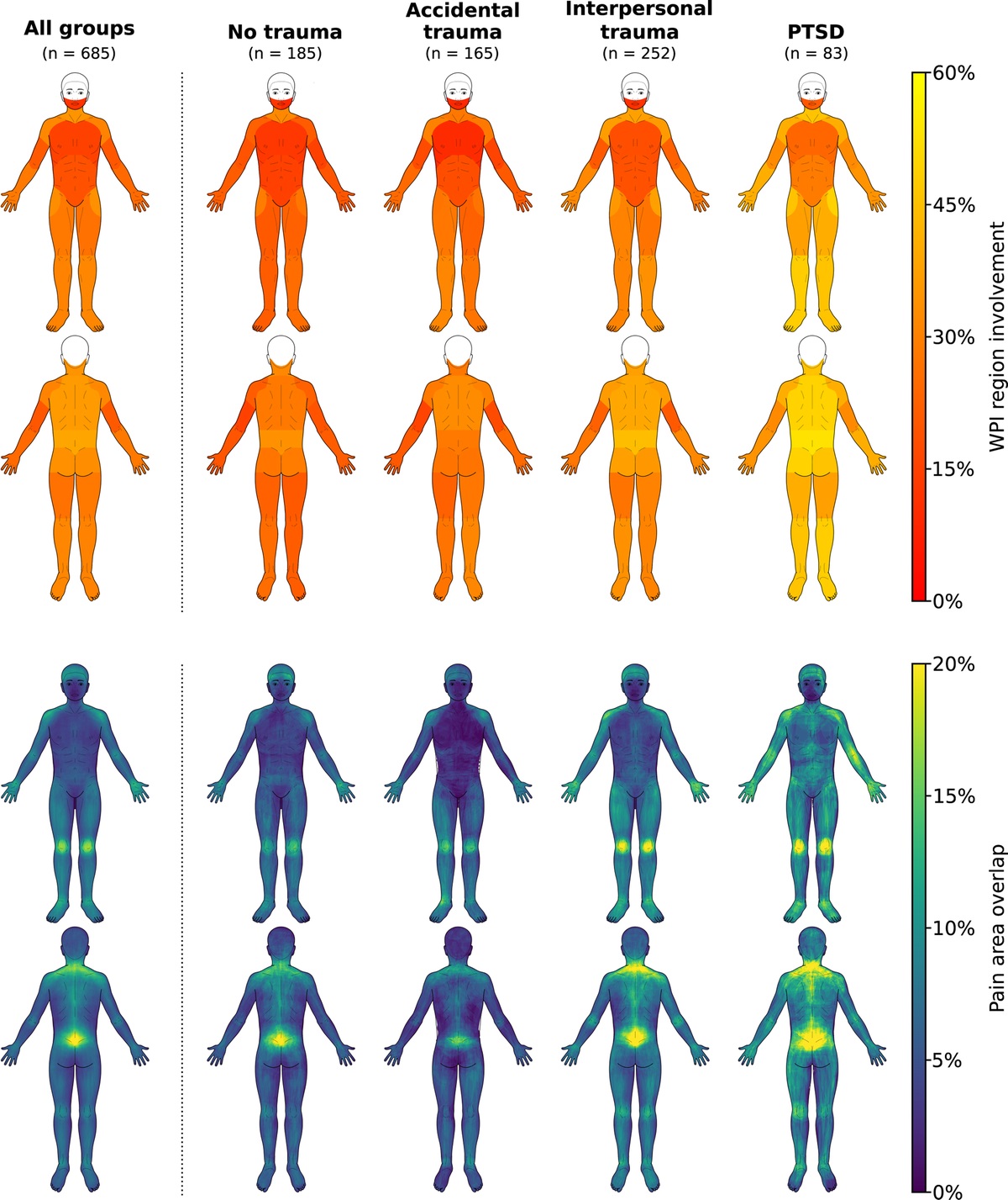 Traumatic Events, Posttraumatic Stress Disorder, and Central Sensitization in Chronic Pain Patients of a German University Outpatient Pain Clinic