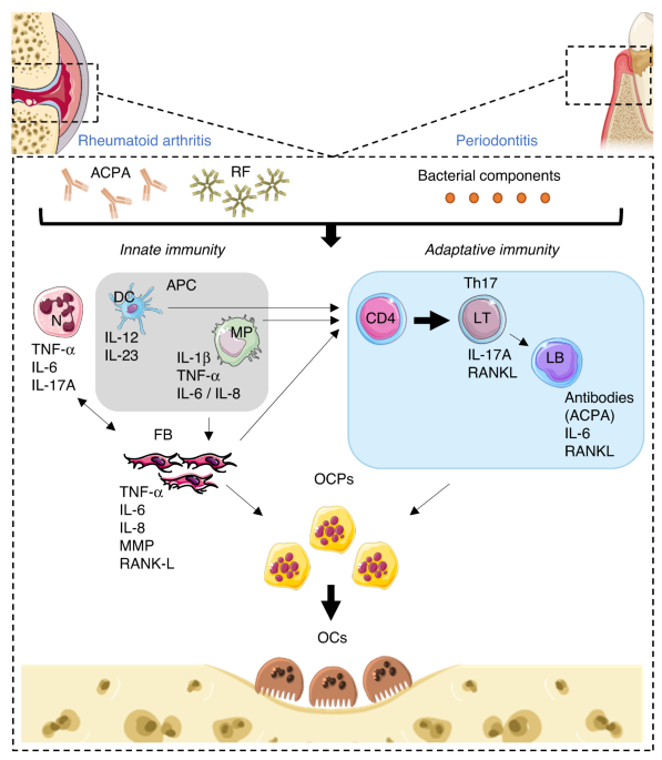 New insights into inflammatory osteoclast precursors as therapeutic targets for rheumatoid arthritis and periodontitis