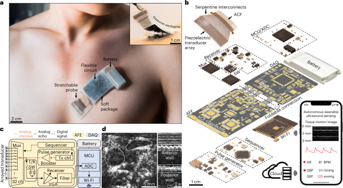 A fully integrated wearable ultrasound system to monitor deep tissues in moving subjects