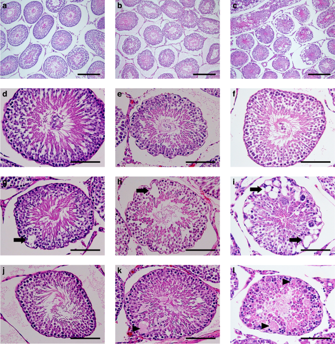Genetic and histopathological analysis of spermatogenesis after short-term testicular torsion in rats