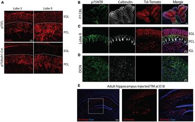 Excess cerebellar granule neurons induced by the absence of p75NTR during development elicit social behavior deficits in mice