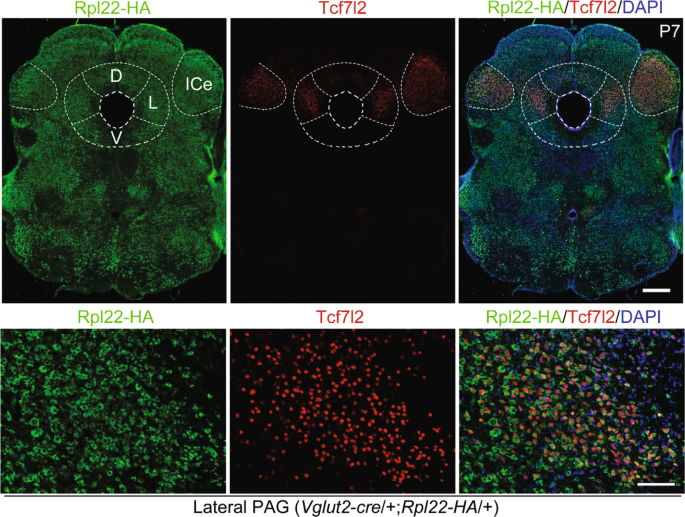 Expression of TCF7L2 in midbrain Vglut2-positive neurons