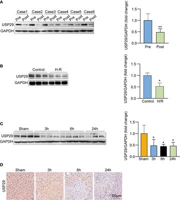 Ubiquitin-specific protease 29 attenuates hepatic ischemia-reperfusion injury by mediating TGF-β-activated kinase 1 deubiquitination