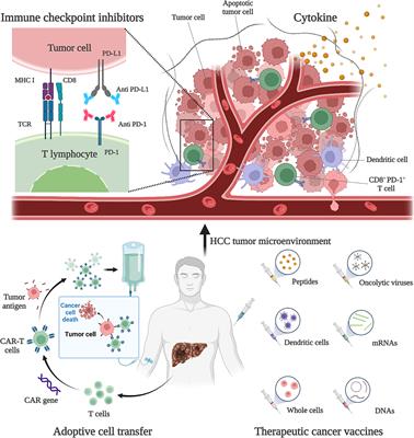 HDAC inhibitors enhance the anti-tumor effect of immunotherapies in hepatocellular carcinoma