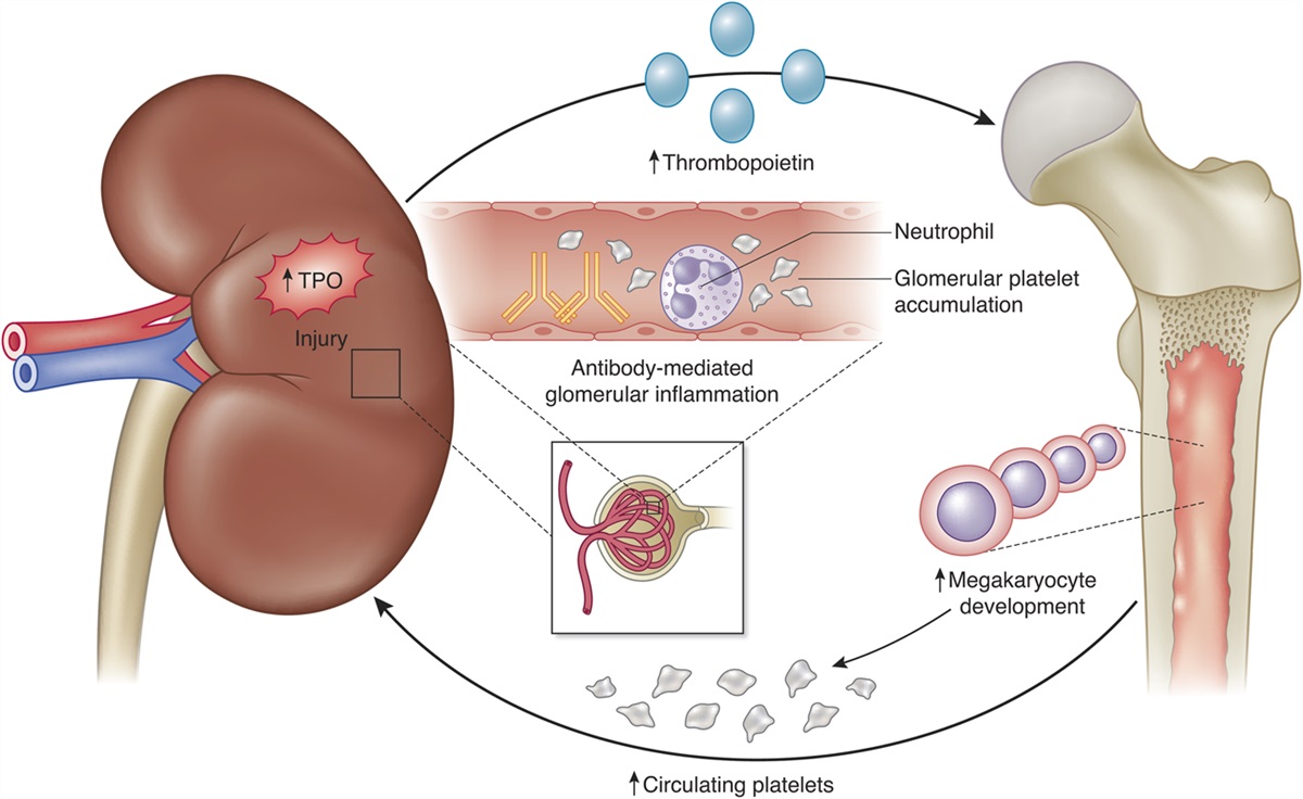 Kidney-Derived Thrombopoietin and Platelet Generation—A Proinflammatory Loop in CKD