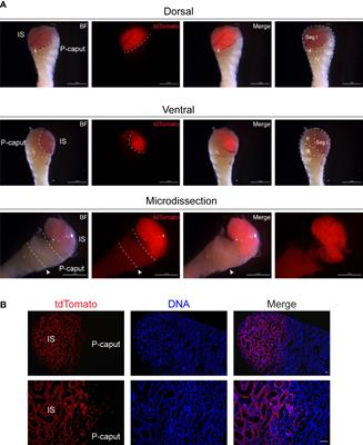 Transcriptome profiling of the initial segment and proximal caput of mouse epididymis