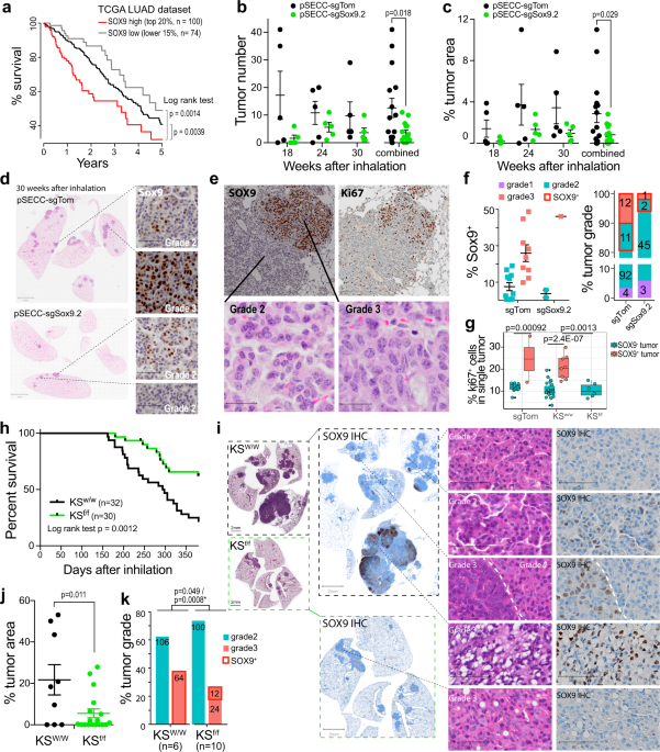 SOX9 drives KRAS-induced lung adenocarcinoma progression and suppresses anti-tumor immunity