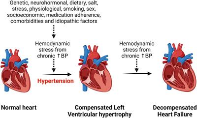 Hypertensive heart disease: risk factors, complications and mechanisms