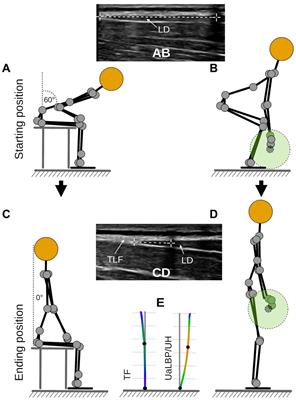 Thoracolumbar fascia deformation during deadlifting and trunk extension in individuals with and without back pain