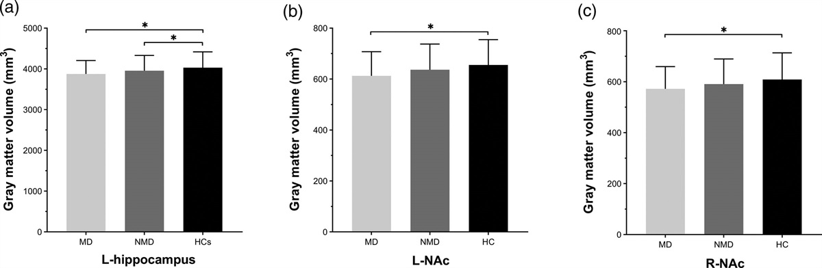 Atrophy of bilateral nucleus accumbens in melancholic depression