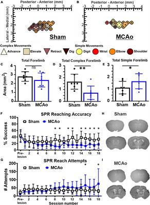 Extensive complex neocortical movement topography devolves to simple output following experimental stroke in mice