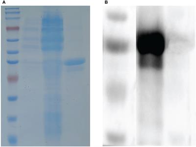 I329L protein-based indirect ELISA for detecting antibodies specific to African swine fever virus