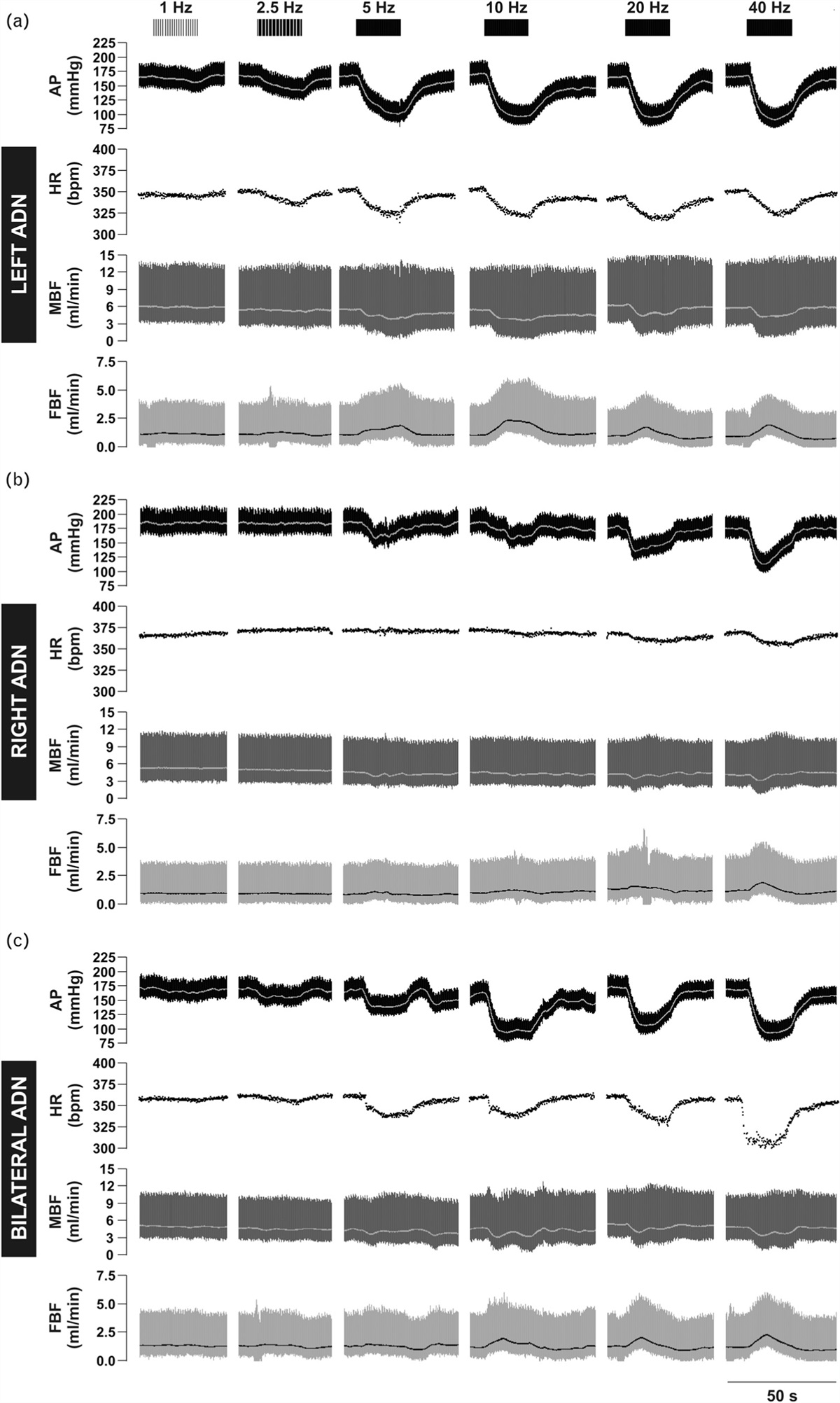 Differential central integration of left versus right baroreceptor afferent input in spontaneously hypertensive rats
