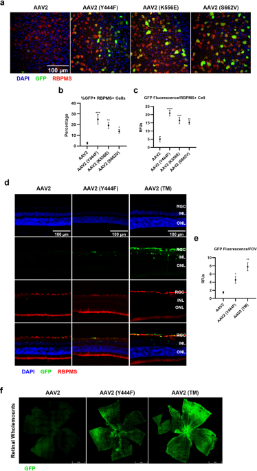 Immunobiology of a rationally-designed AAV2 capsid following intravitreal delivery in mice