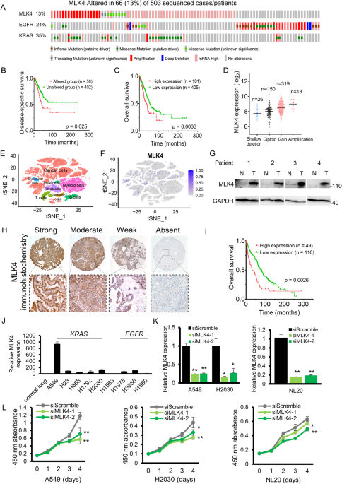 MLK4 promotes glucose metabolism in lung adenocarcinoma through CREB-mediated activation of phosphoenolpyruvate carboxykinase and is regulated by KLF5