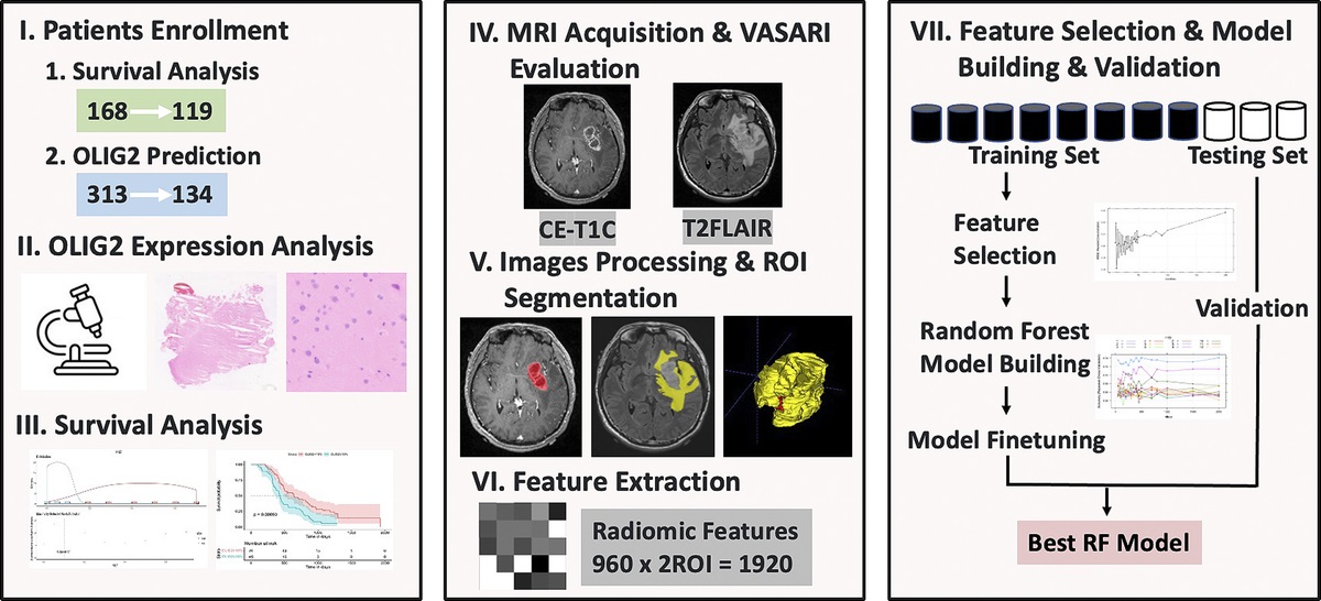 Oligodendrocyte Transcription Factor 2 as a Potential Prognostic Biomarker of Glioblastoma: Kaplan-Meier Analysis and the Development of a Binary Predictive Model Based on Visually Accessible Rembrandt Image and Magnetic Resonance Imaging Radiomic Features