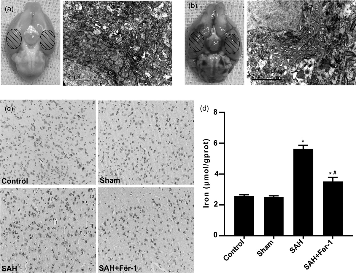 Ferrostatin-1 attenuates brain injury in animal model of subarachnoid hemorrhage via phospholipase A2 activity of PRDX6