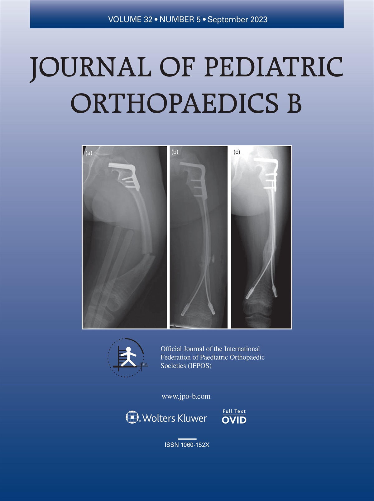 Comment on Cummings JL et al.: ‘Untreated congenital vertical talus deformity in walking age: minimally invasive method works’