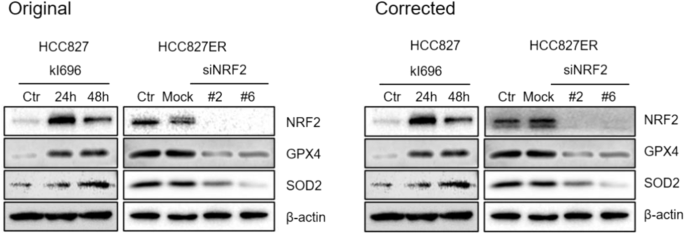 Author Correction: NRF2-GPX4/SOD2 axis imparts resistance to EGFR-tyrosine kinase inhibitors in non-small-cell lung cancer cells