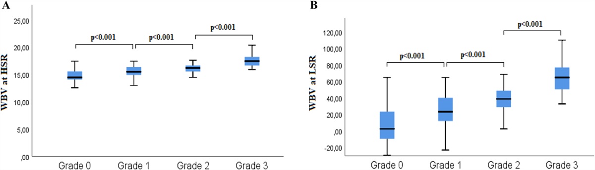 The Relationship Between Nitrate-Induced Headache and -Blood Viscosity: An Observational Prospective Study