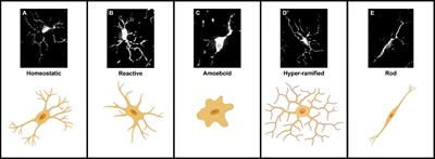 Microglial morphometric analysis: so many options, so little consistency