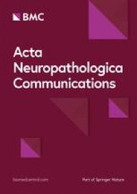 A novel ELOVL4 variant, L168S, causes early childhood-onset Spinocerebellar ataxia-34 and retinal dysfunction: a case report
