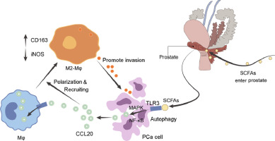 Gut microbiota-derived short-chain fatty acids promote prostate cancer progression via inducing cancer cell autophagy and M2 macrophage polarization