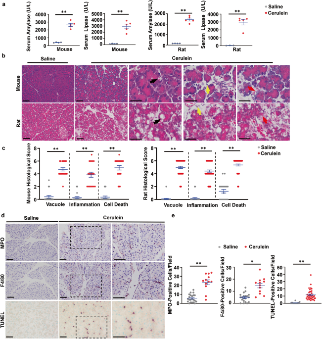 Decreased syntaxin17 expression contributes to the pathogenesis of acute pancreatitis in murine models by impairing autophagic degradation