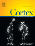 The role of visual imagery in face recognition and the construction of facial composites. Evidence from Aphantasia