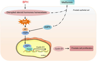 Metformin: A promising clinical therapeutical approach for BPH treatment via inhibiting dysregulated steroid hormones-induced prostatic epithelial cells proliferation