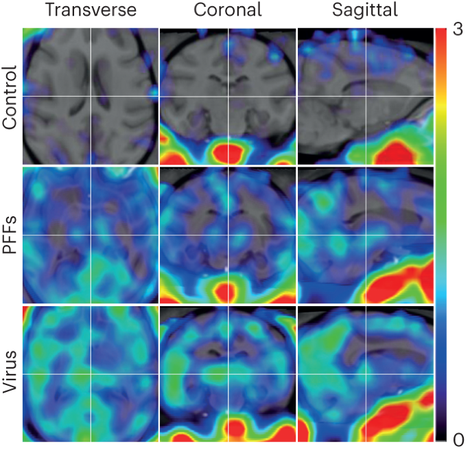 Seeing α-synuclein fibrils