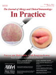 Dupilumab to Treat Drug Reaction with Eosinophilia and Systemic Symptoms: A Case Series