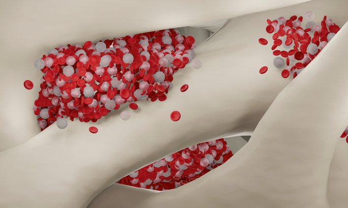 In vivo editing of blood stem cells