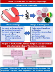 ISE/ISHNE Expert Consensus Statement on ECG Diagnosis of Left Ventricular Hypertrophy: The Change of the Paradigm. The joint paper of the International Society of Electrocardiology and the International Society for Holter Monitoring and Noninvasive Electrocardiology